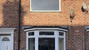 Cosmetic Improvement in Liverpool photo